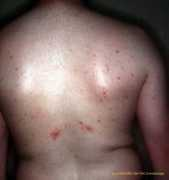 dermatologie.free.fr Fopo