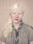manzardcafe.blog.hu Albinos