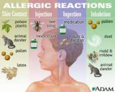 atlaschr.com Allergy