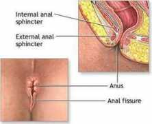 Anal