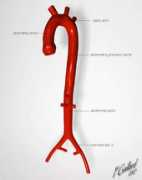 Aorta