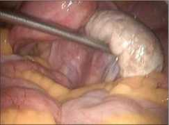 gynecendoscopy.org Arunbhai