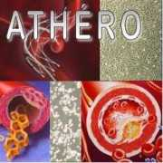unamur.be Athero