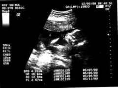 austinray.net Babyray