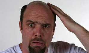 yourhealthblog.net Baldman