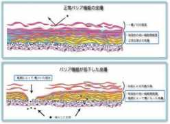 kudan-atopy.com Barriar