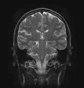 blogs.abc.net.au Beiske