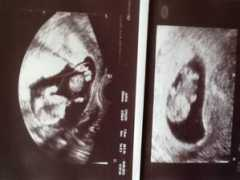 diskuze.maminkam.cz Belhana