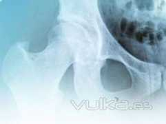 galeria.vulka.es Biosalud