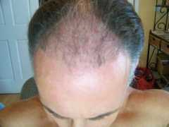 hairsite.com Bisanga