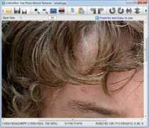 snapfiles.com Blemish