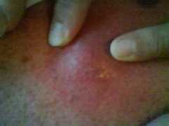 Boil