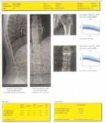 cyrusdiagnostic.com Boned
