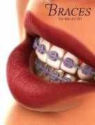 daz3d.com Braces
