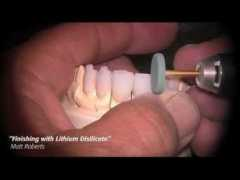 videos.lugarlatino.com Brasseler