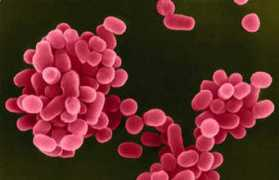 scitechdaily.com Brucella