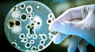 scitechdaily.com Brucella
