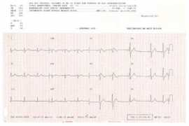 londonarrhythmiacentre.co.uk Brugada