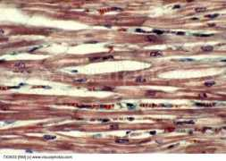visualphotos.com Cardiac