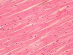 eugraph.com Cardiac