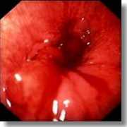 endoskopischer-atlas.de Cardial