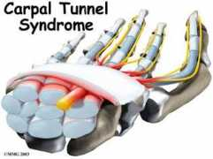 funscrape.com Carpal