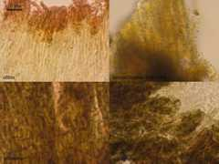 Cassandrae