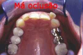 atmbr.com Causas