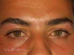 Cejas