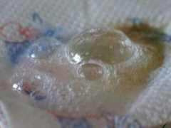 Celice