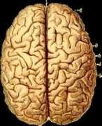 Cerveau