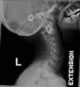draryan.com Cervical