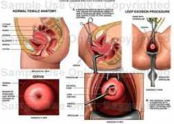 funscrape.com Cervical
