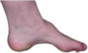 funscrape.com Charcot