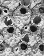bryozoa.net Charrot