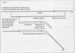 Ciaglia