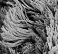 xtec.cat Cilis