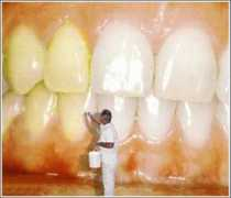 perguntascretinas.com.br Clareamento