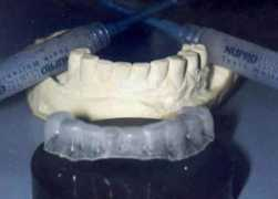 saude.hsw.uol.com.br Clareamento