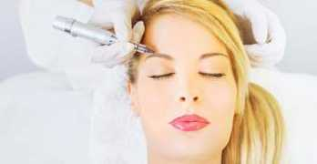 caras.uol.com.br Clareamento