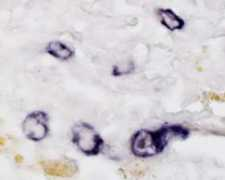 Cmv