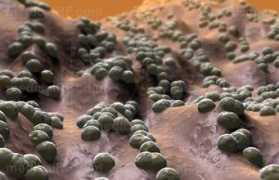Cocci