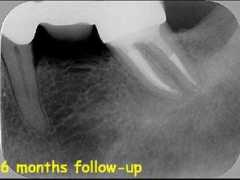 dentalindia.com Cpro