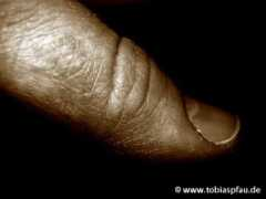 Daumen