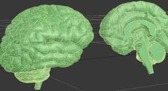 flashbrainanatomy.com Dbrain