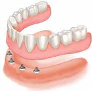 drwilliamjrobinson.com Denture