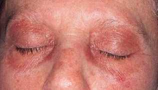mrcophth.com Dermato