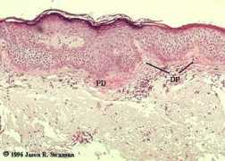 Dermis