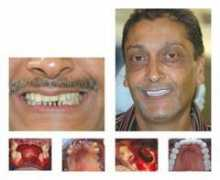thisisdentistry.co.uk Dhamelia
