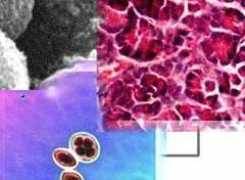 Diagnostica